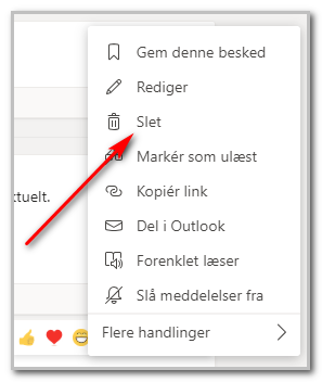 Slet_besked.png